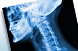 xray 1
