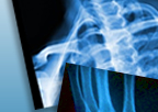 xray 2