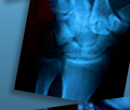 xray 3