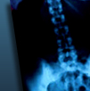 xray 4